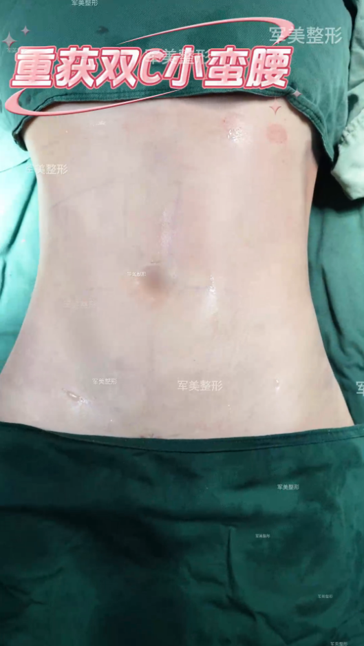 GET 流畅好看小蛮腰💛