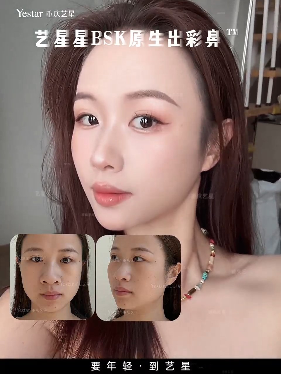真实变美日记🥰