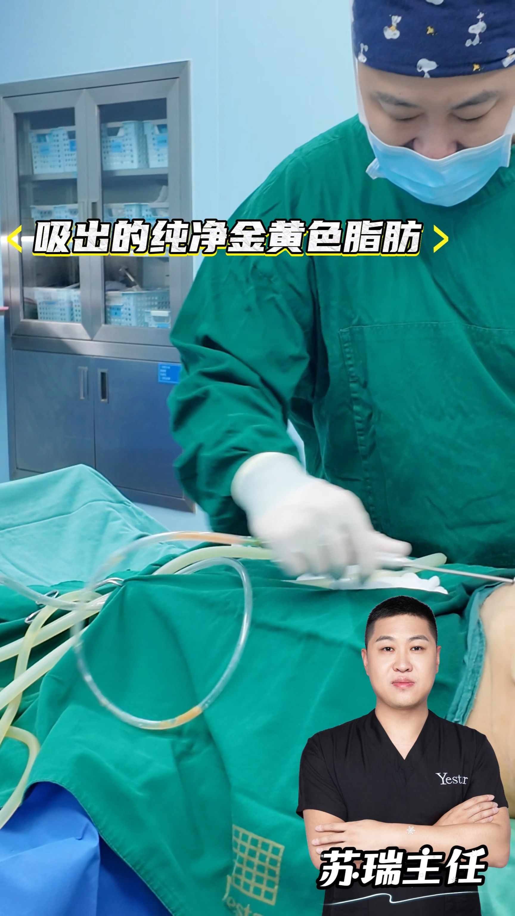 吸脂手术实录