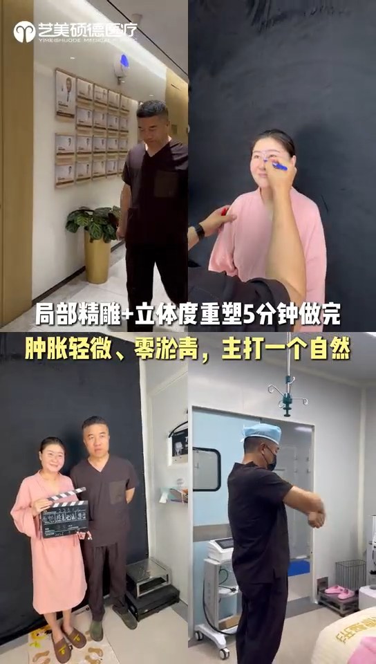 全脸精雕！！