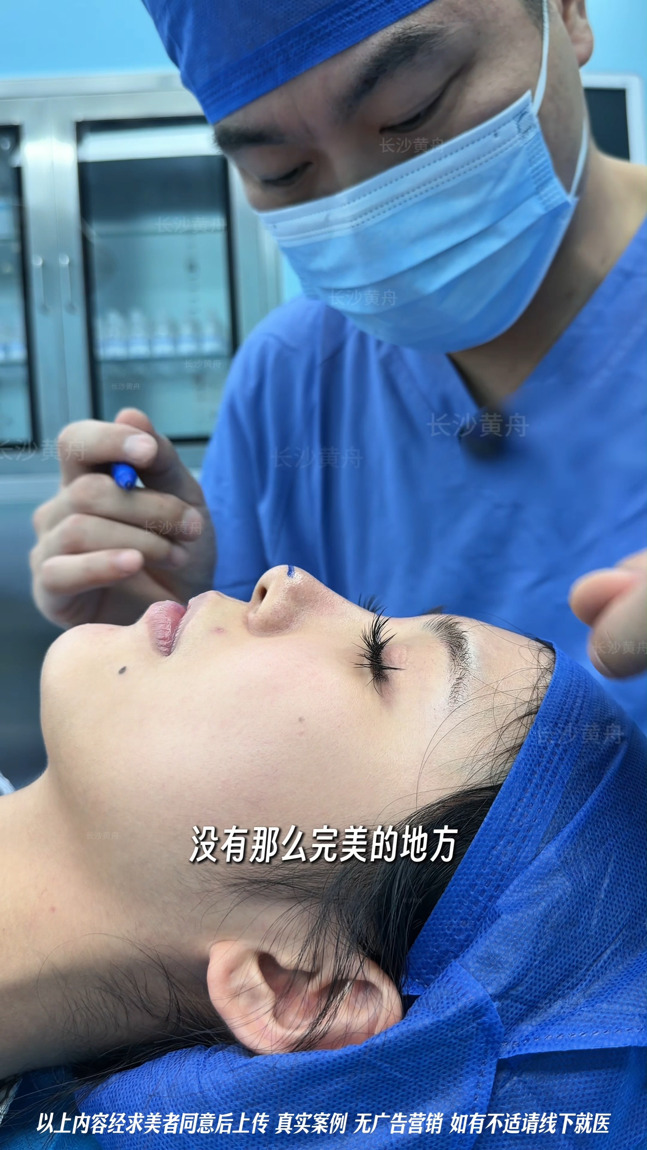 do了个👃后，小美变顶美🆙~