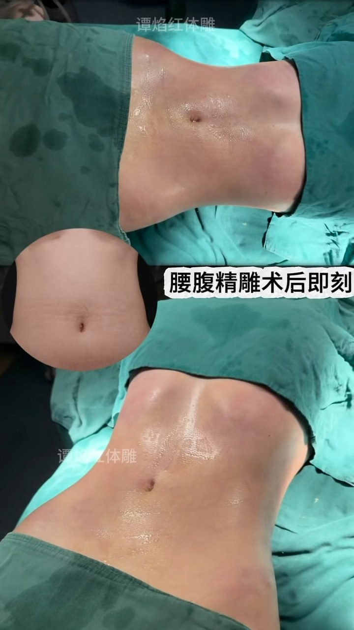 #带你逆袭好身材