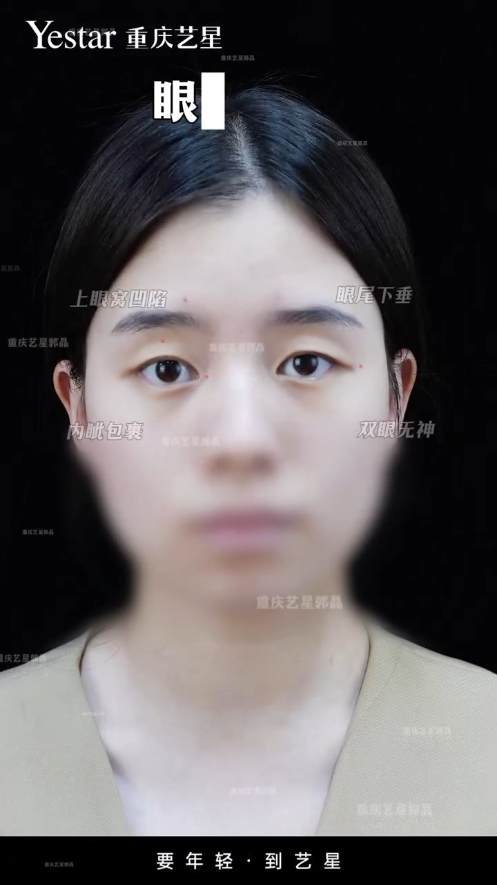 精细化眼综合调整后✅