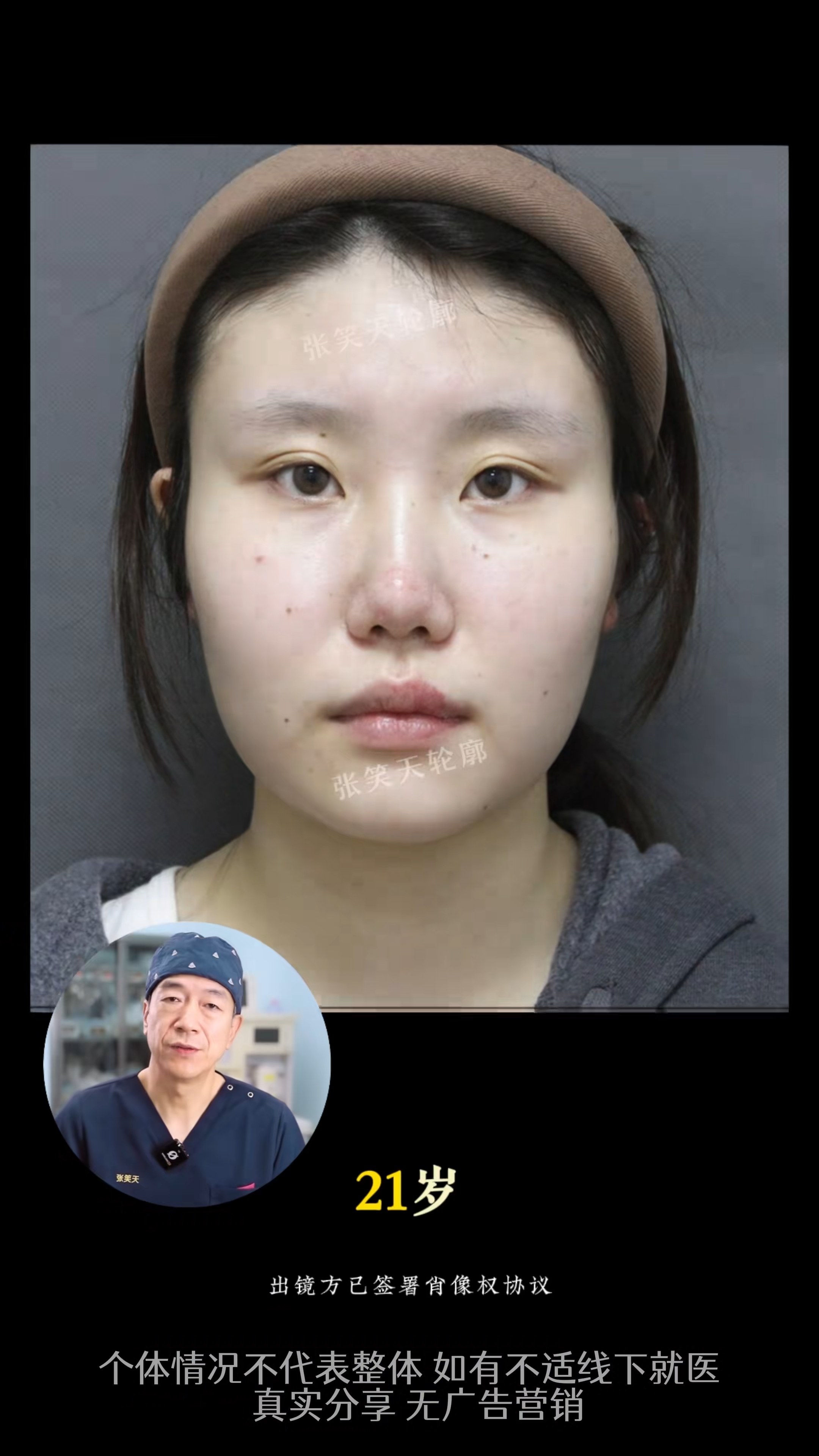 案例分享
