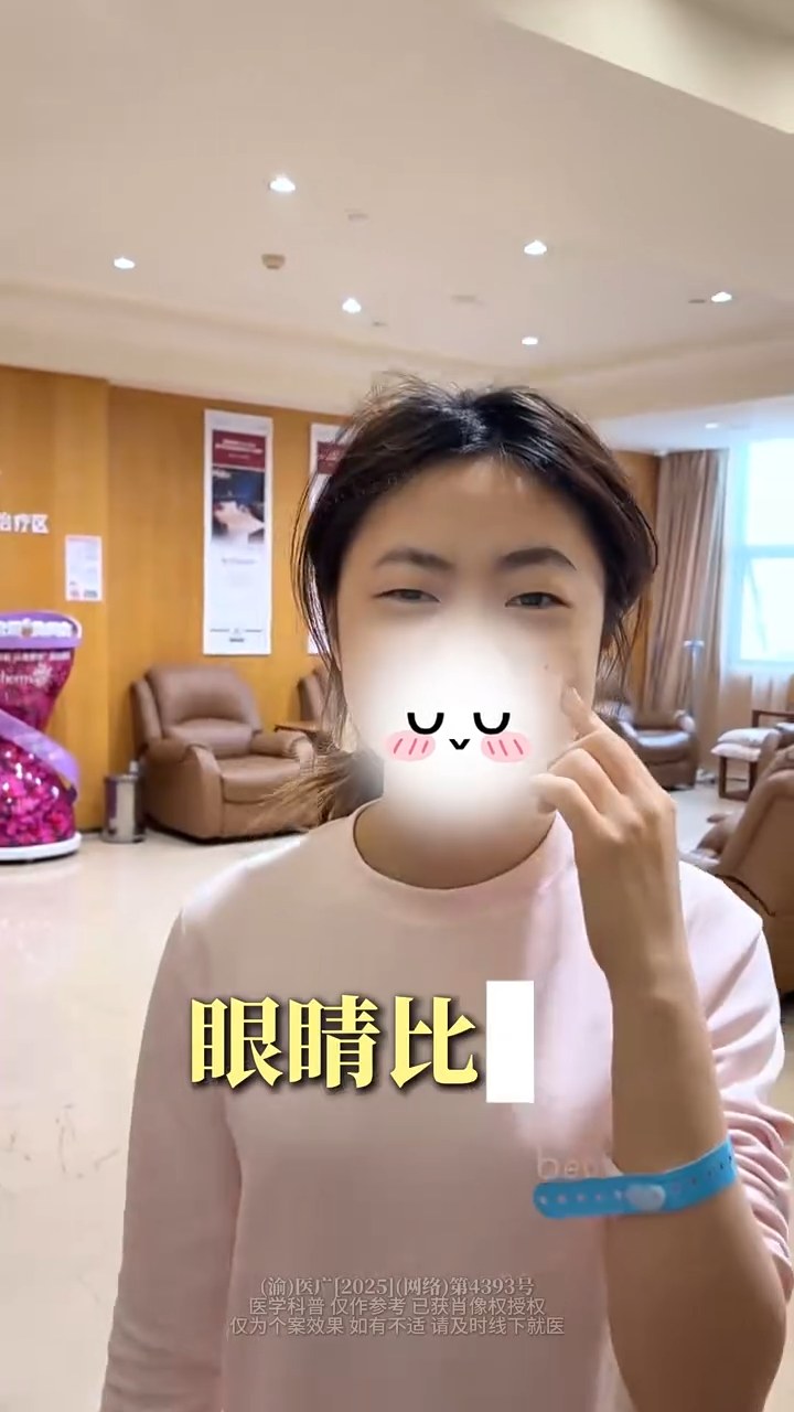 无神单眼皮➡️妈生灵动小开扇✨