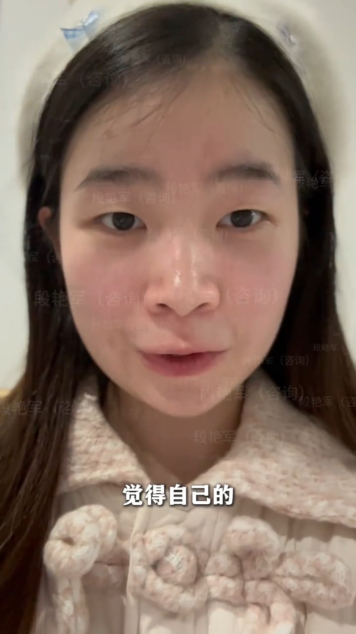少女时代的淤青……
