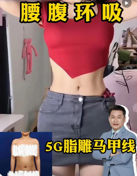 腰腹环吸：5G脂雕马甲线，术后两个月反馈