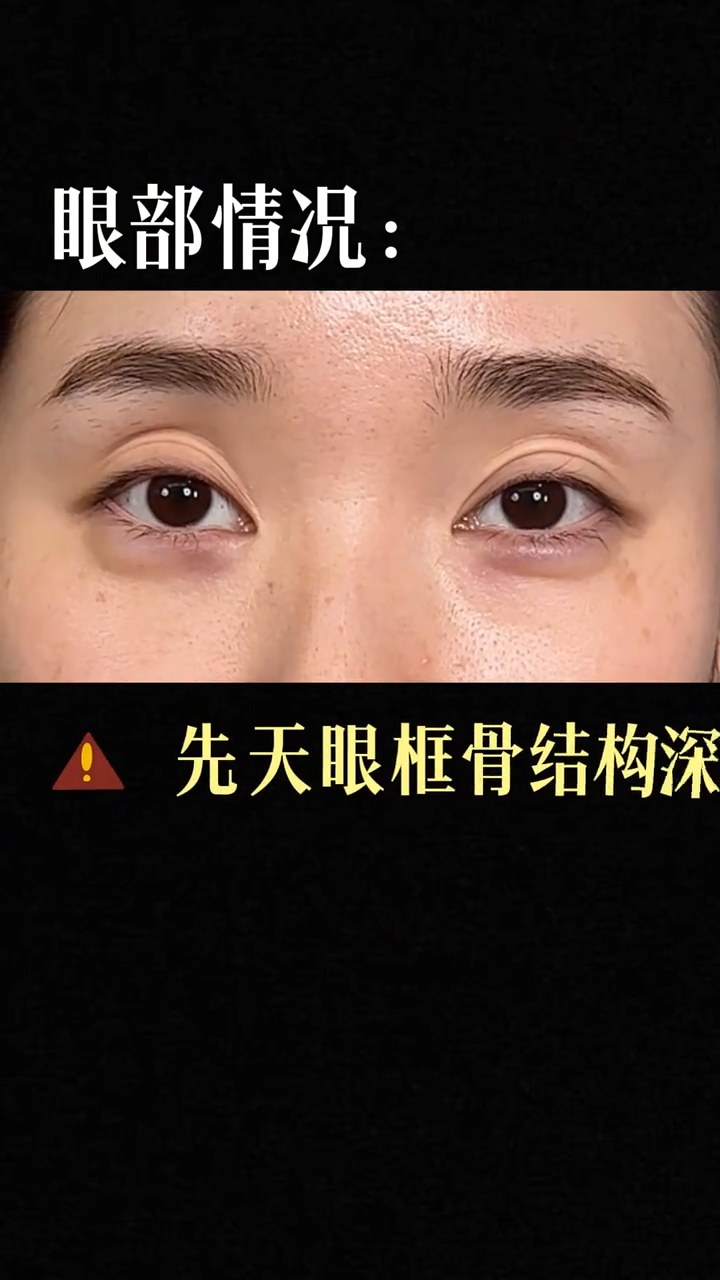 眼窝嘭起来对一个人精气神改变真的非常大！