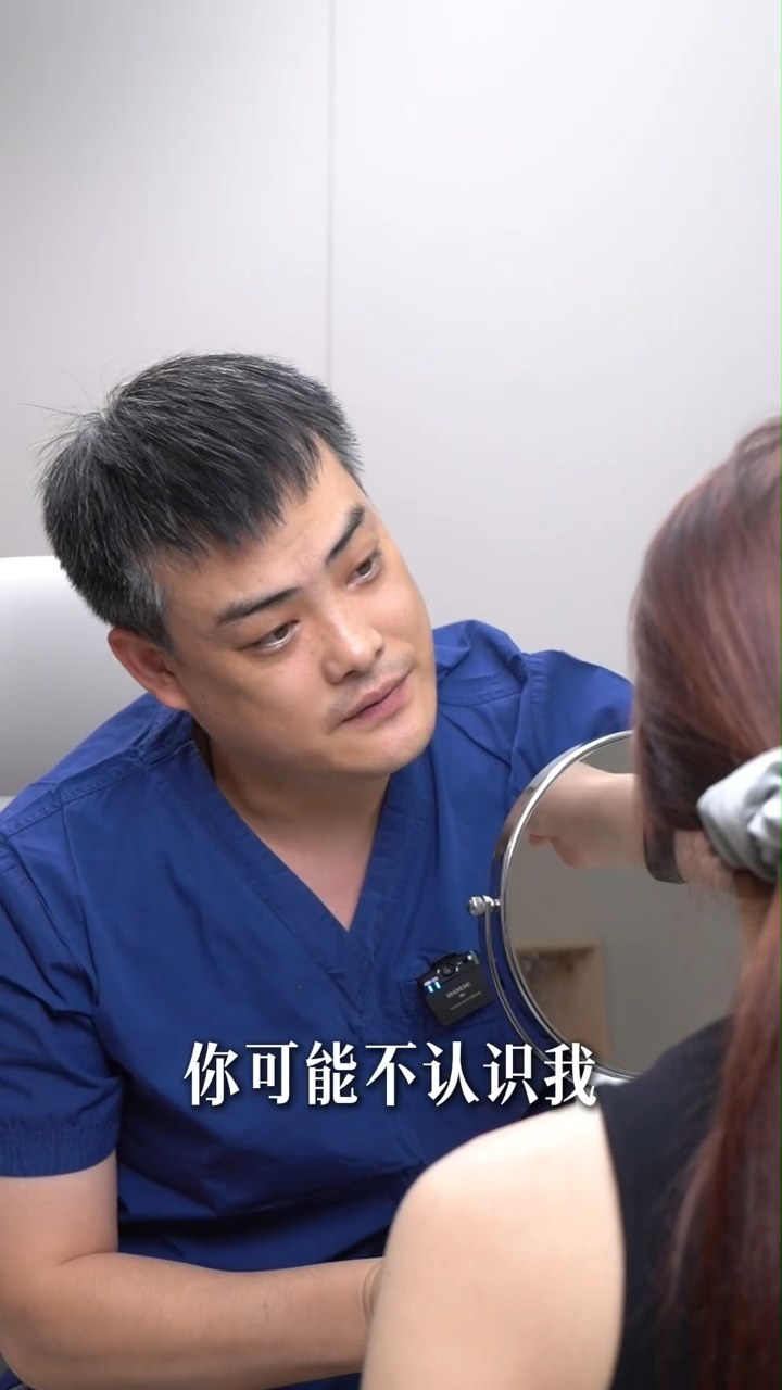 深圳隆鼻圣手|谁懂这妈生自然的鼻子！