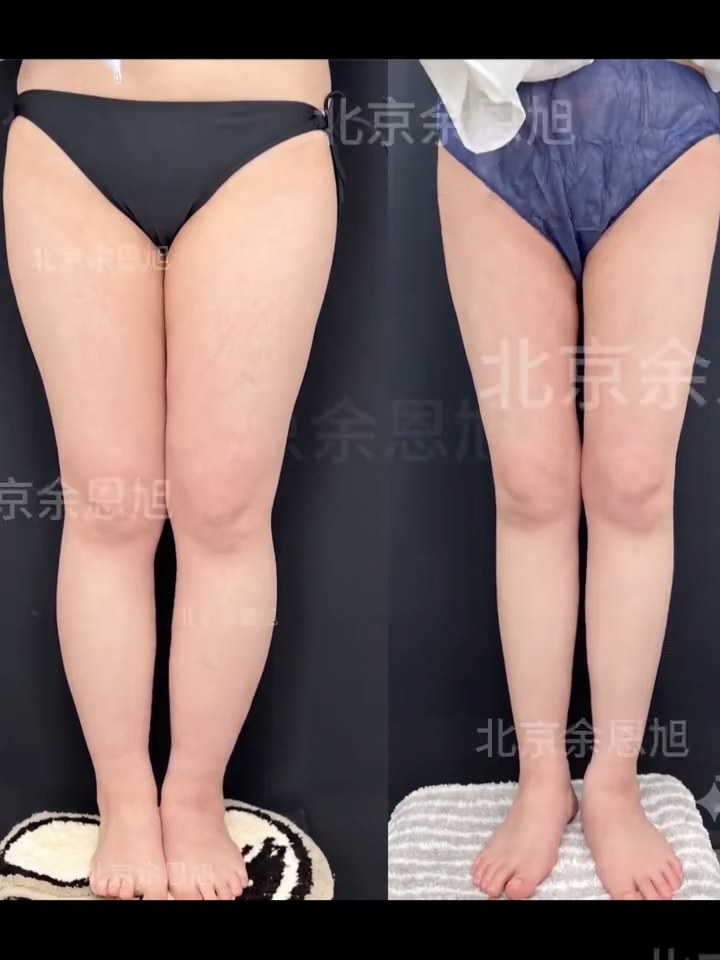 案例分享