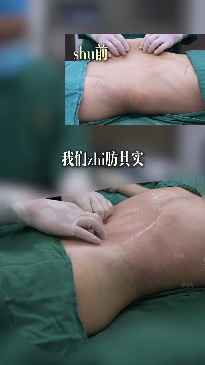 双C腰打造✨