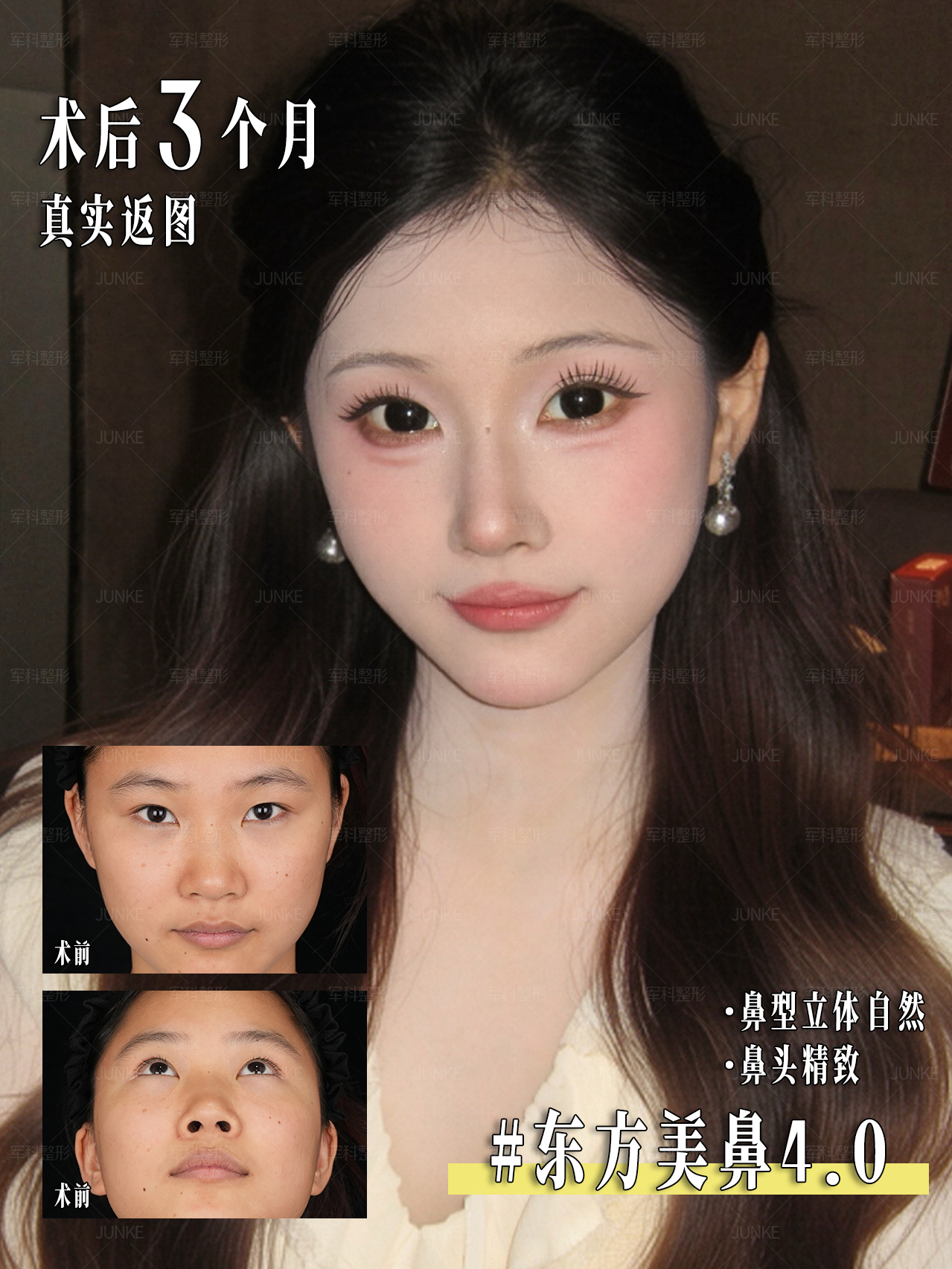 喜欢自然不夸张的鼻子看过来🙋