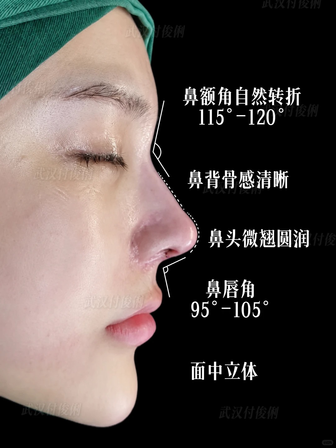 气质一下子提升了！ 3