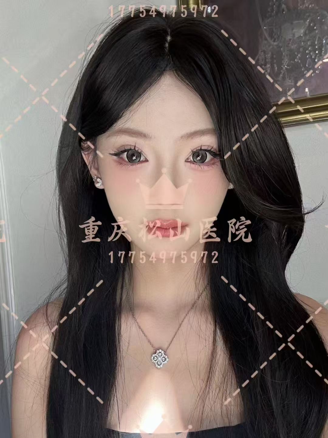 轮廓术后带来的自信具象化啦 1