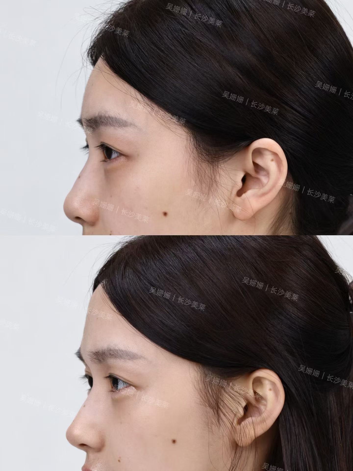 疲态菱形脸爆改温婉气质脸✨ 5