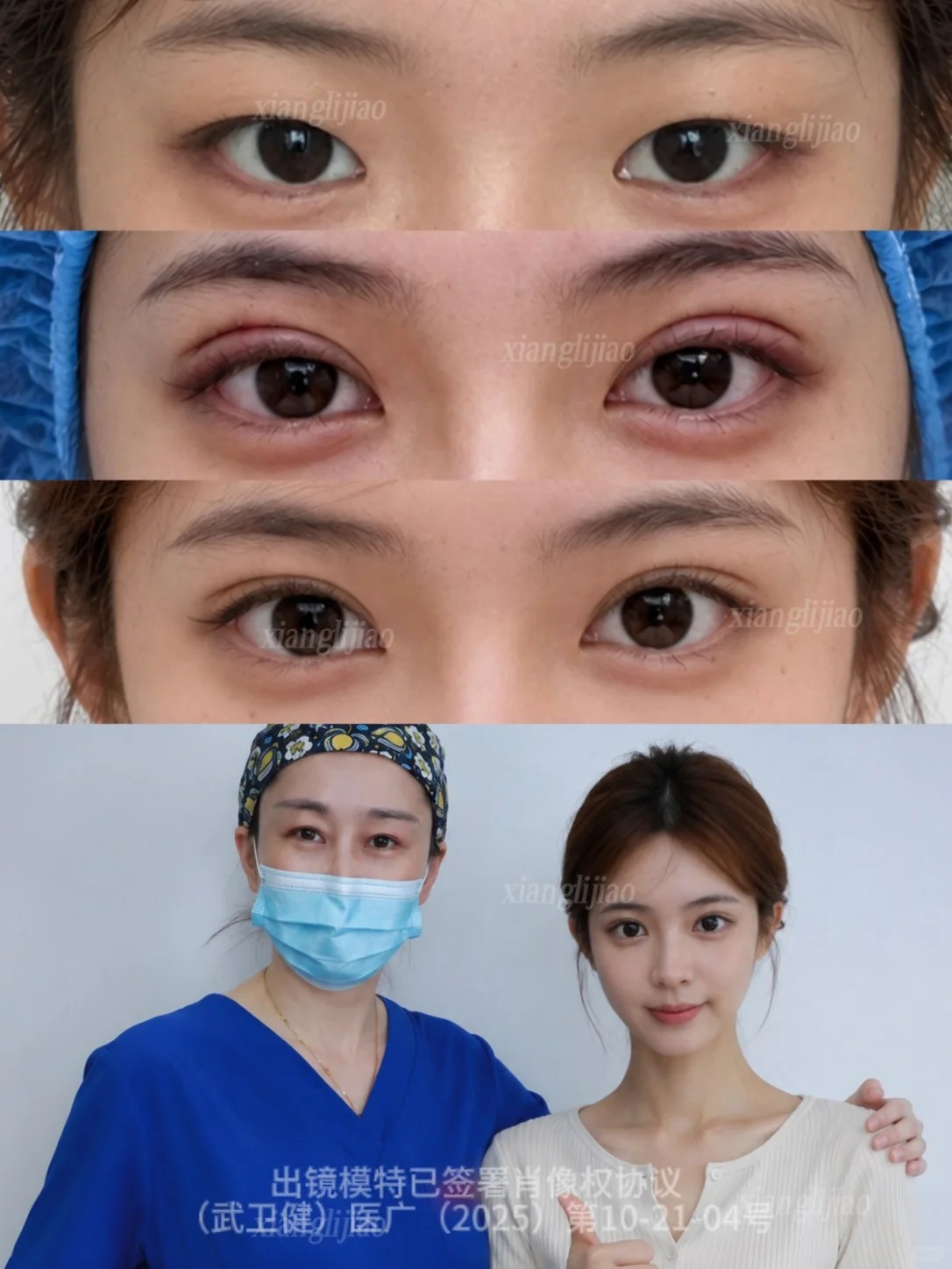 6.8mm开扇 甜酷女孩get～ 3
