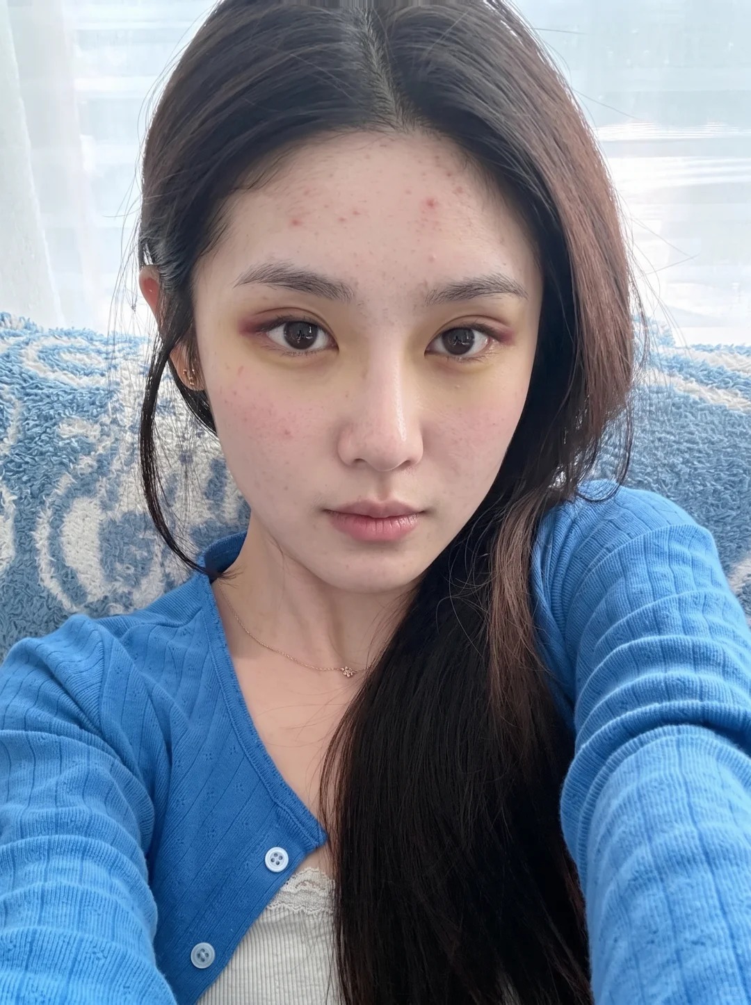 扬起来的双眼皮好像更合适 1