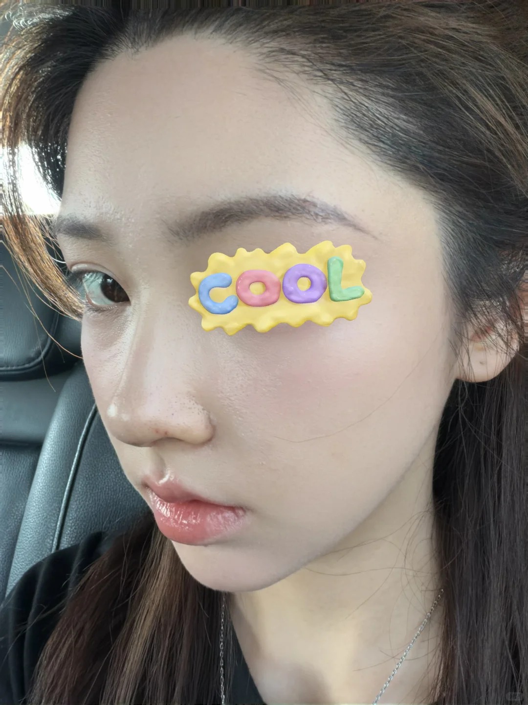 术后效果不错呢 1