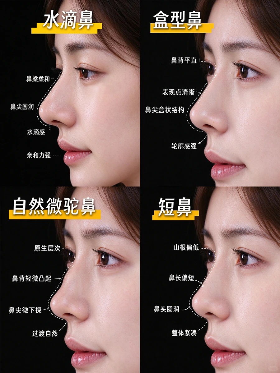 8 款热门鼻子模板对照 2