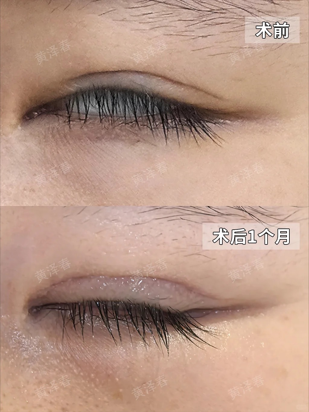 高难度眼修复 2