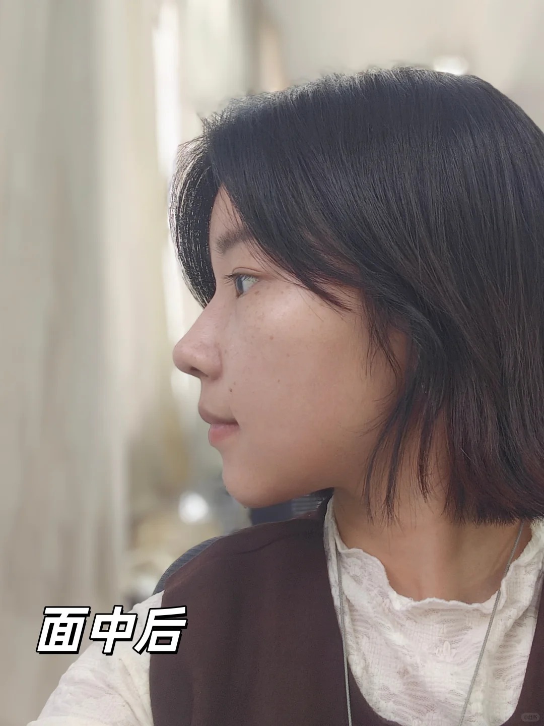 拉完面中三个月 2
