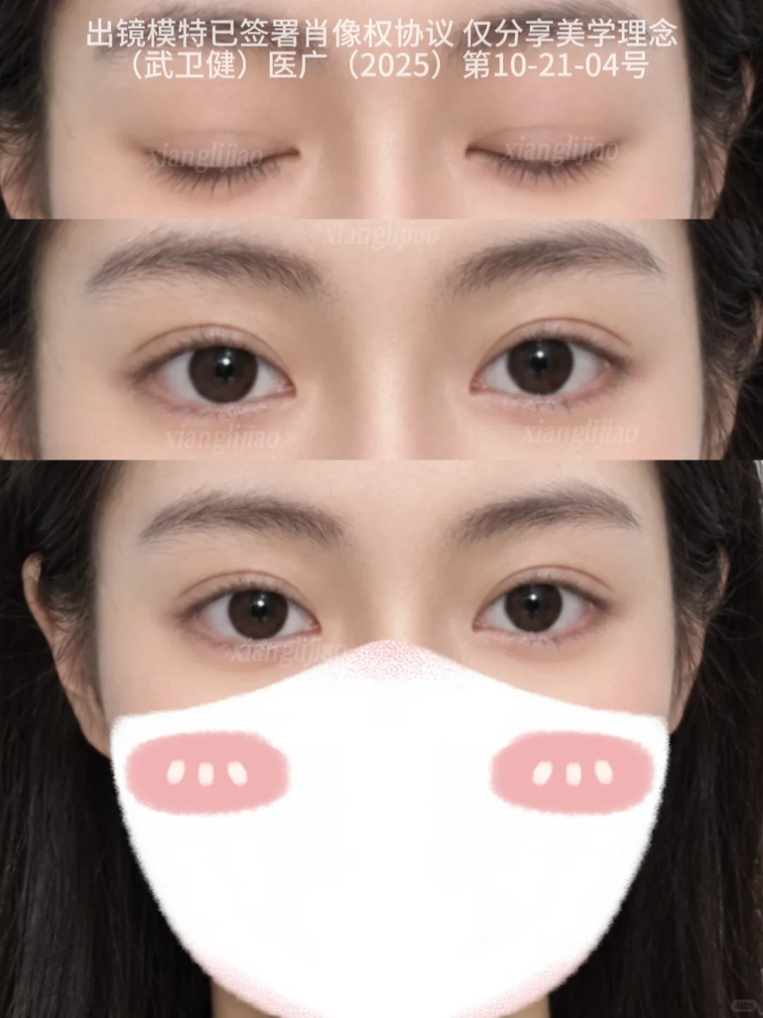 7.5mm开扇～ 1