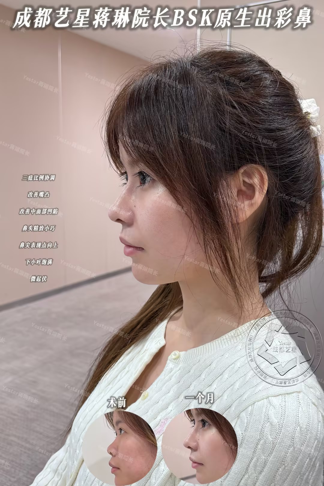 微调鼻型，协调三庭 1