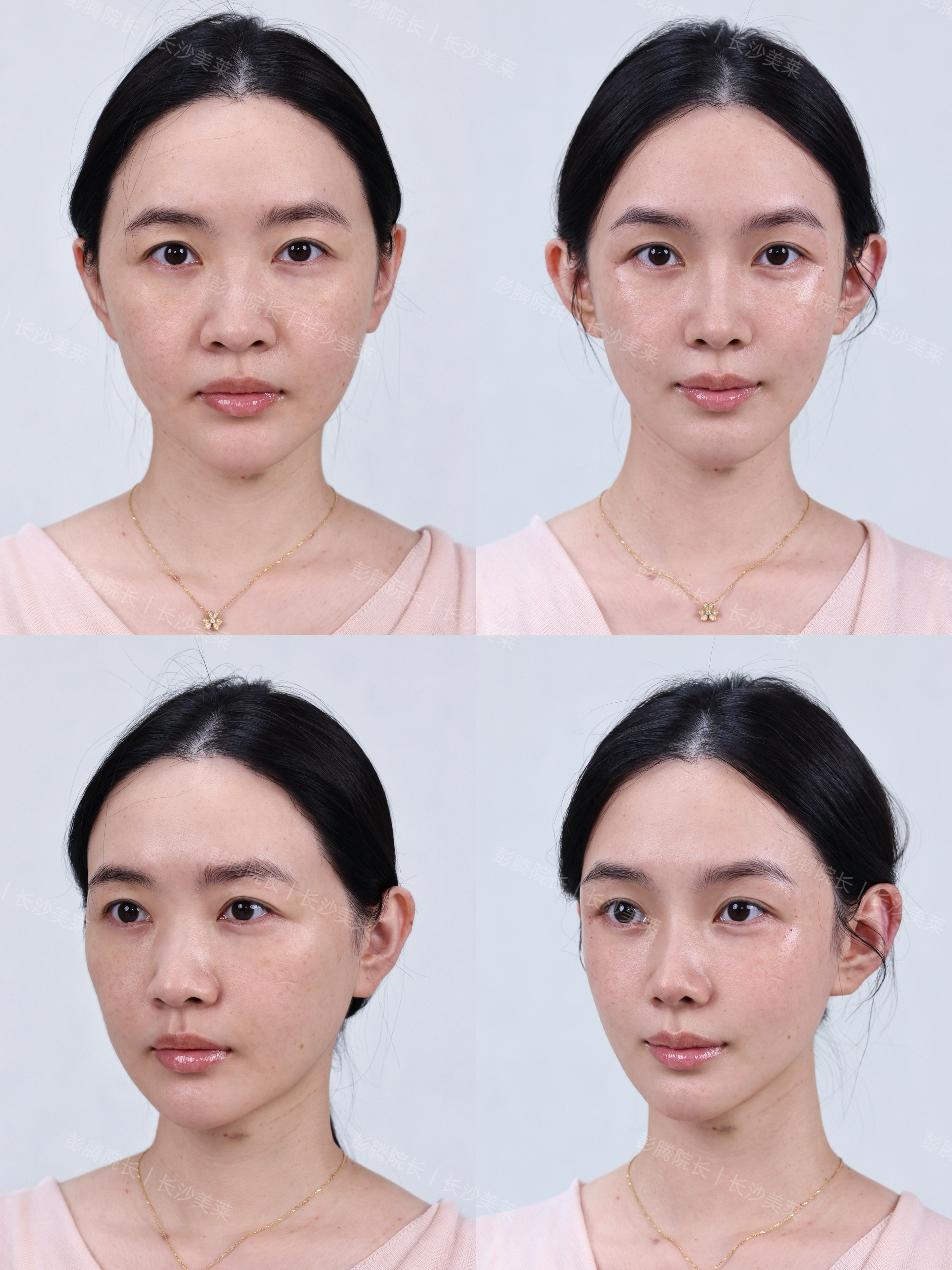 彭腾院长案例分享 3