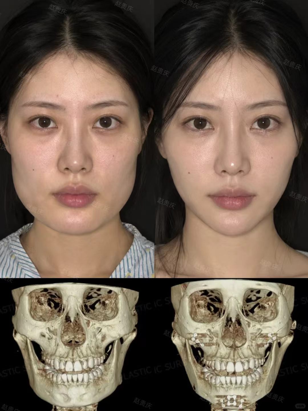 精致脸型的打造 1