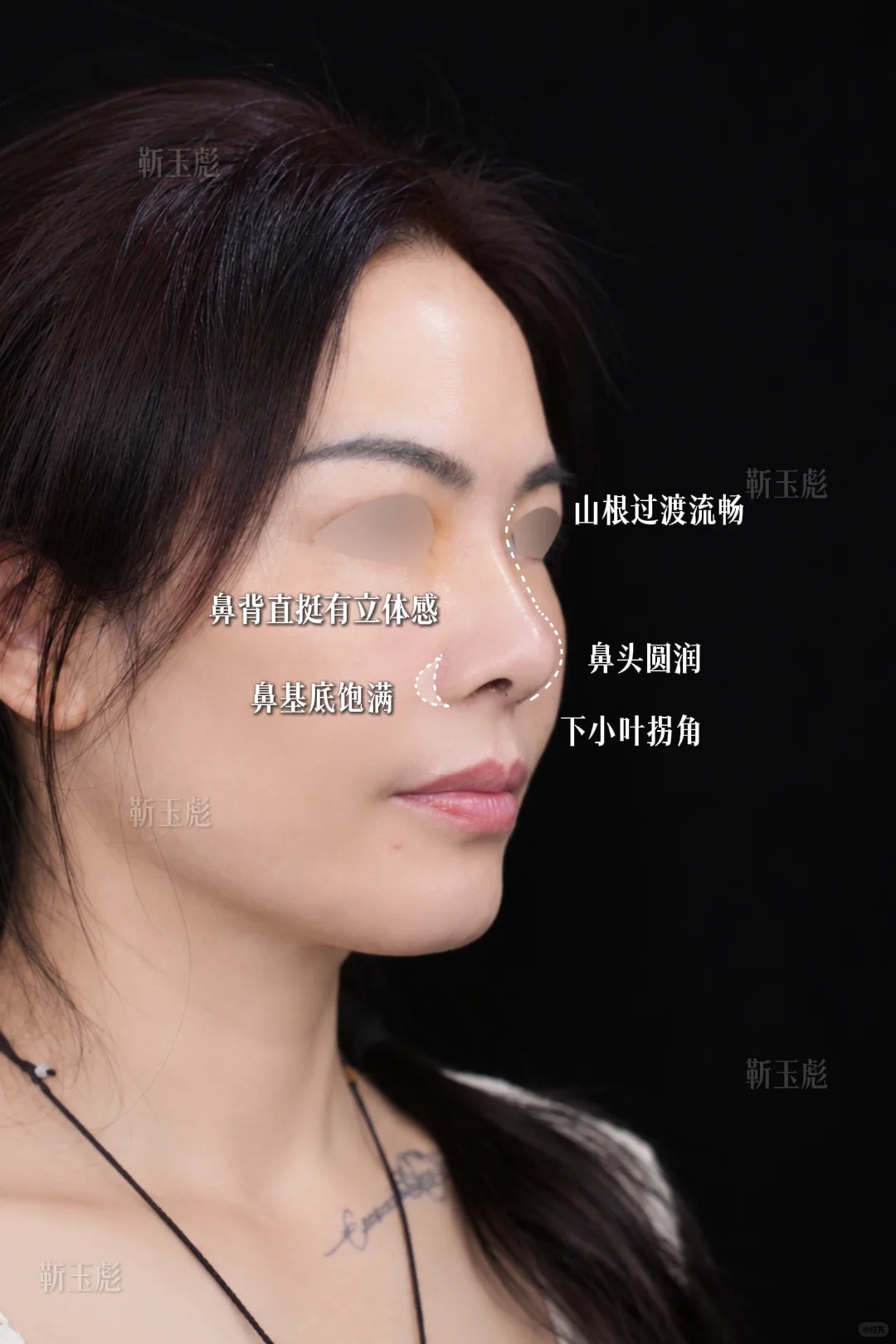 直鼻微翘 1