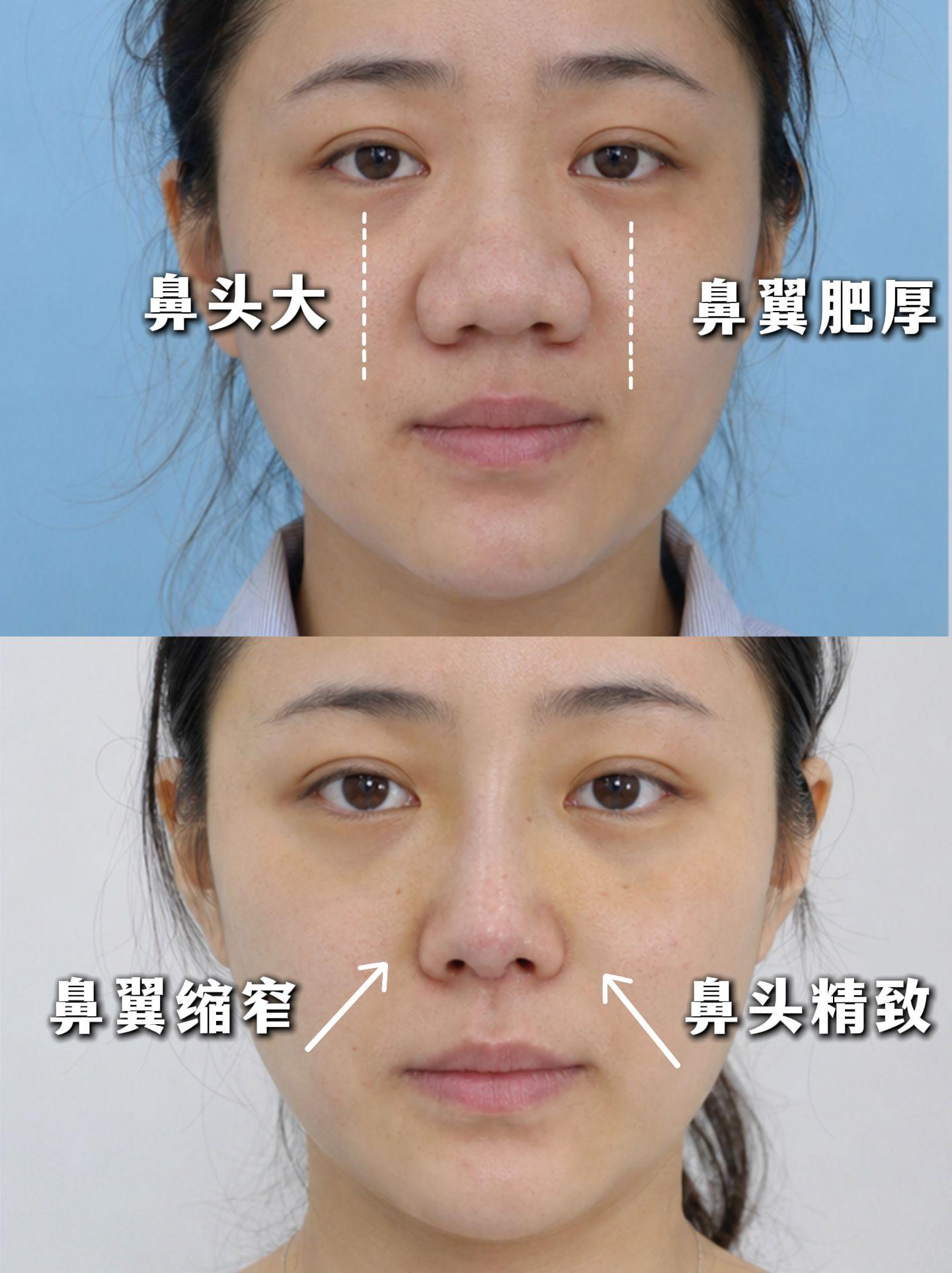 我变好看了吗 2