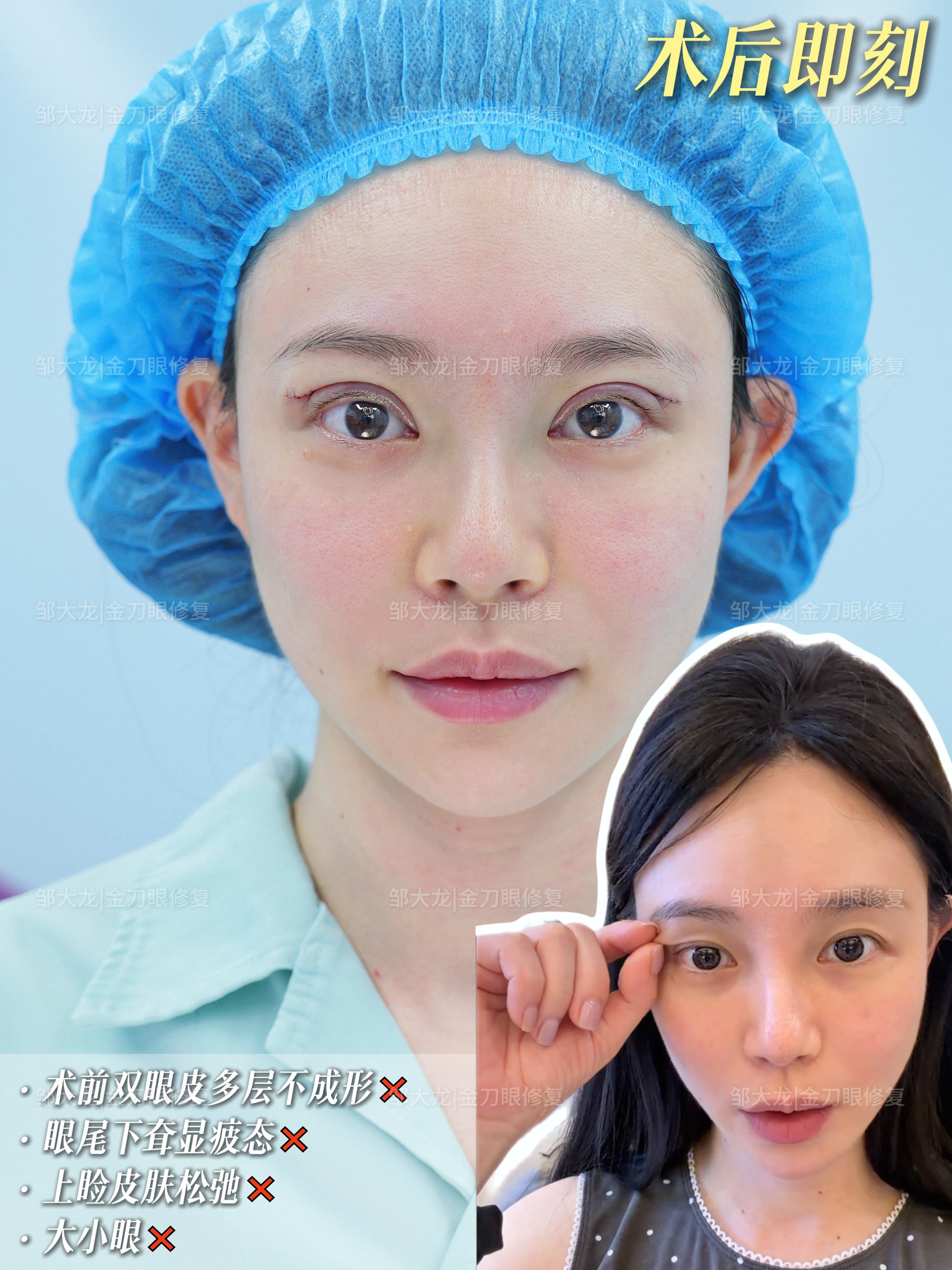 阿尔法定制美眼 1