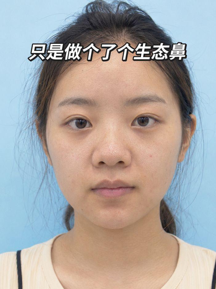只是做了个生态鼻…