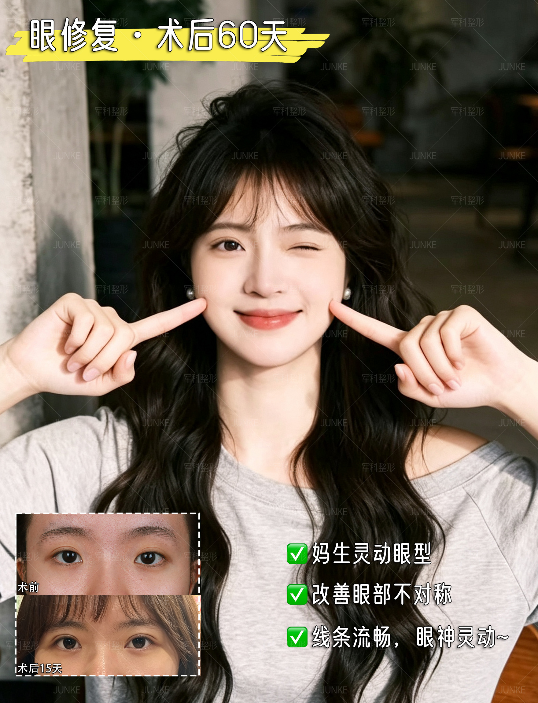 眼修复术后60天分享 1