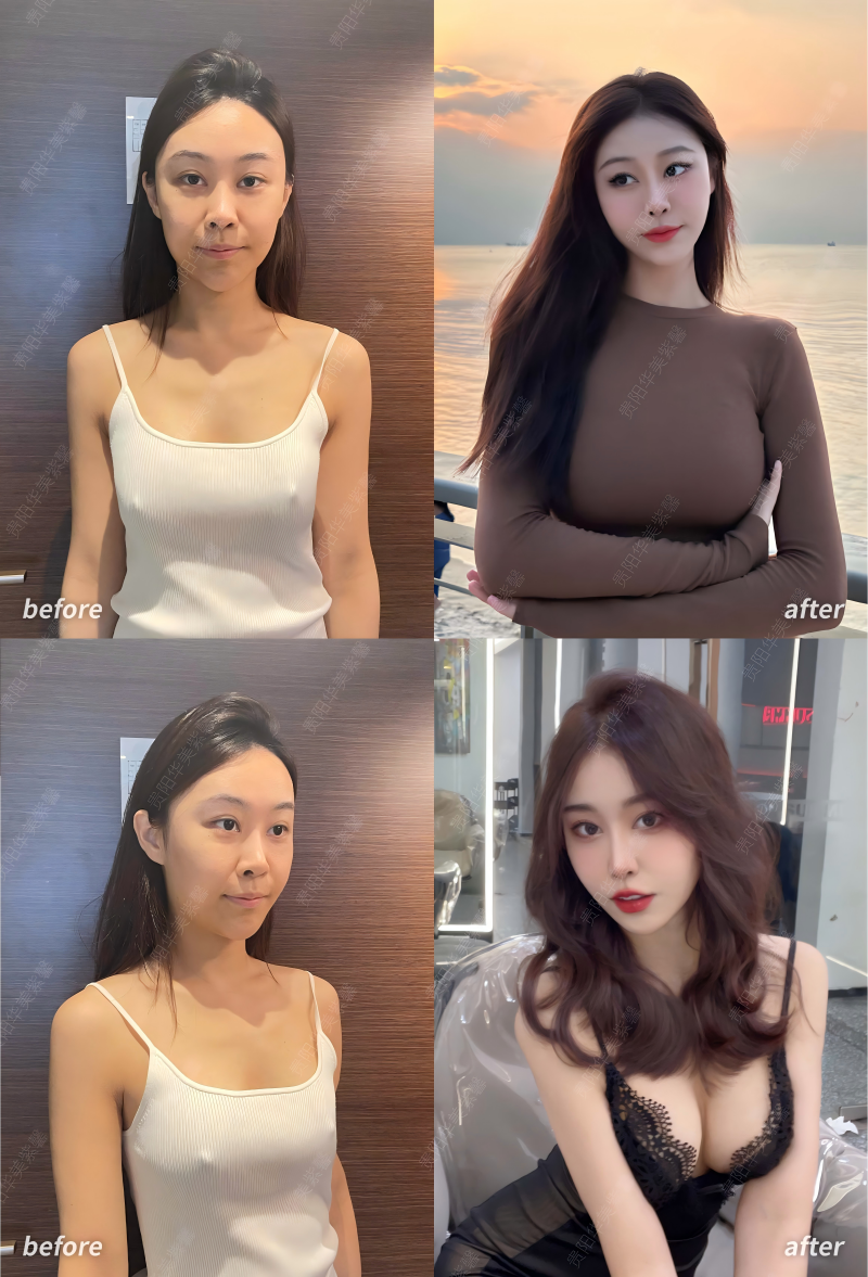 原生美胸案例 1