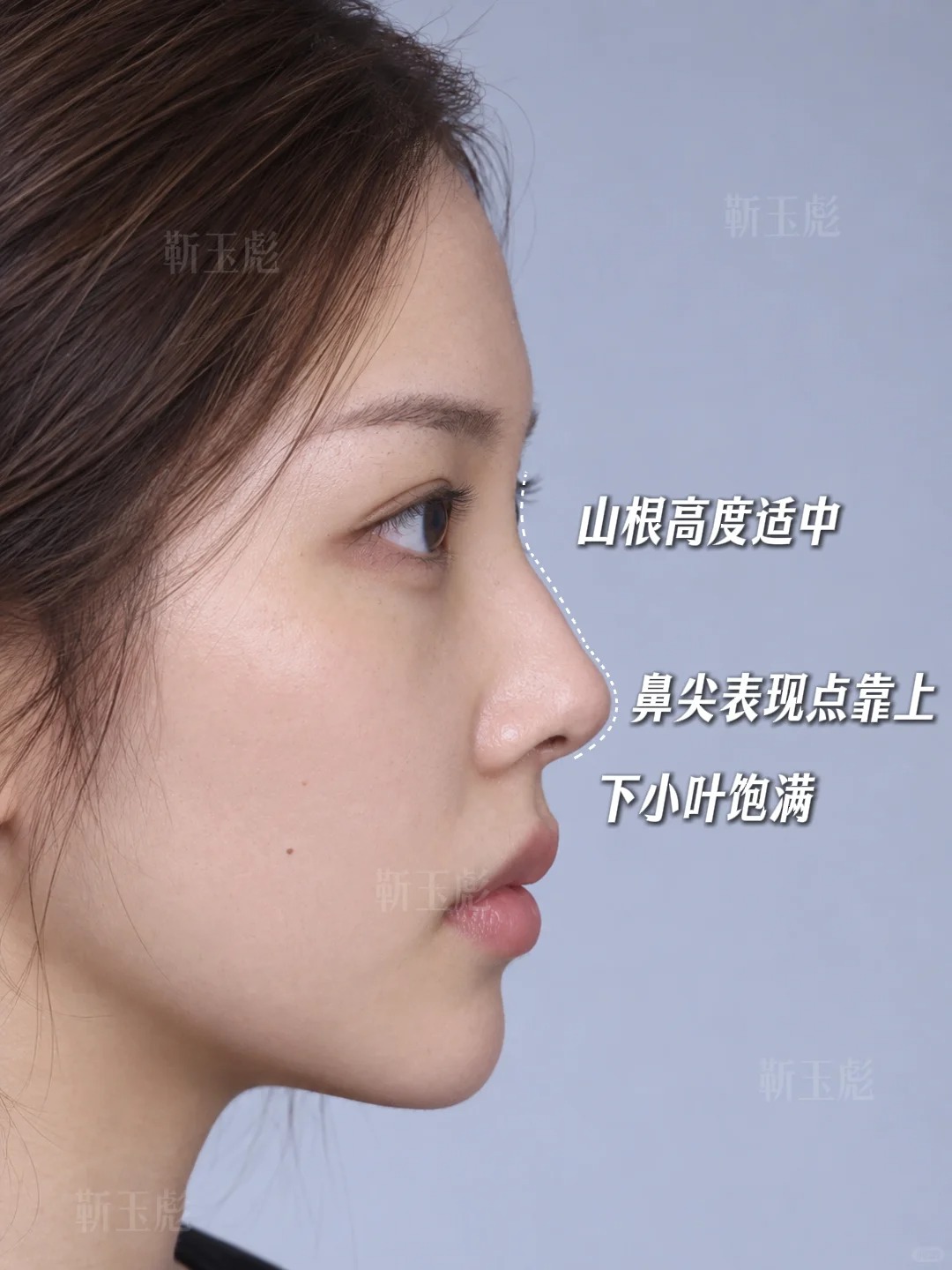 北京鼻子丨直鼻微翘 3