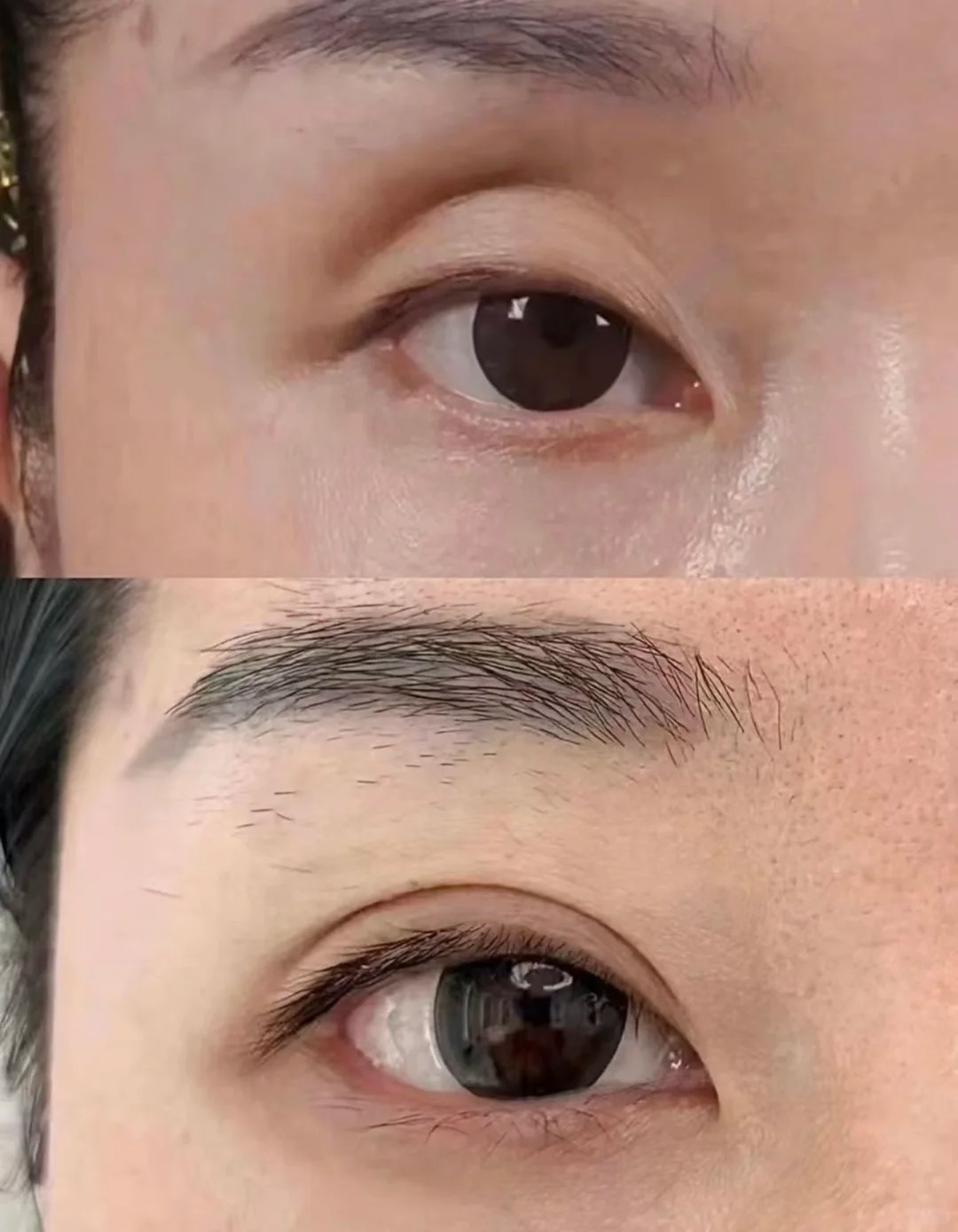 眼眶不凹陷了 视觉看起来年轻了好多 1