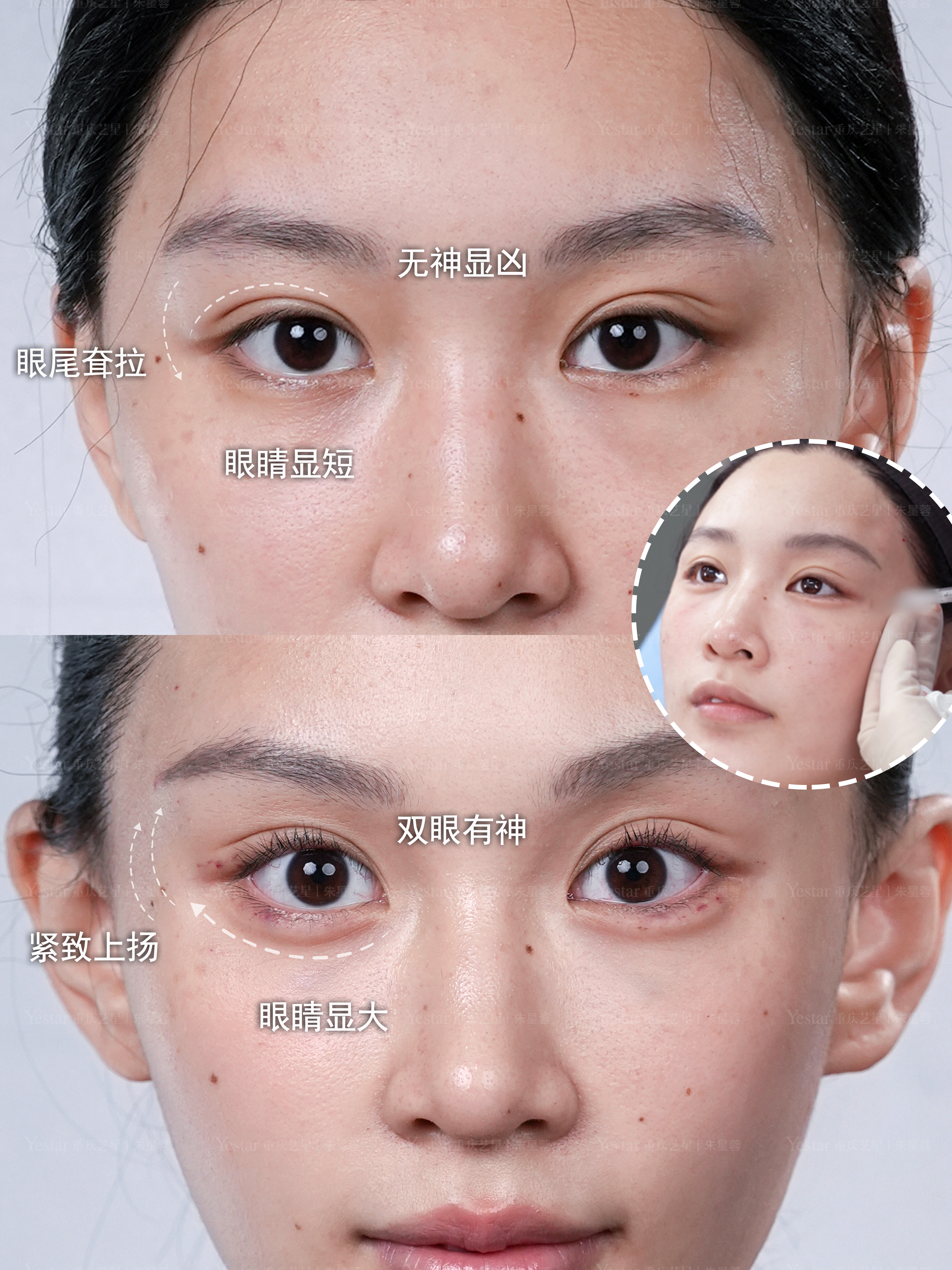 眼型视觉放大 2 倍 1