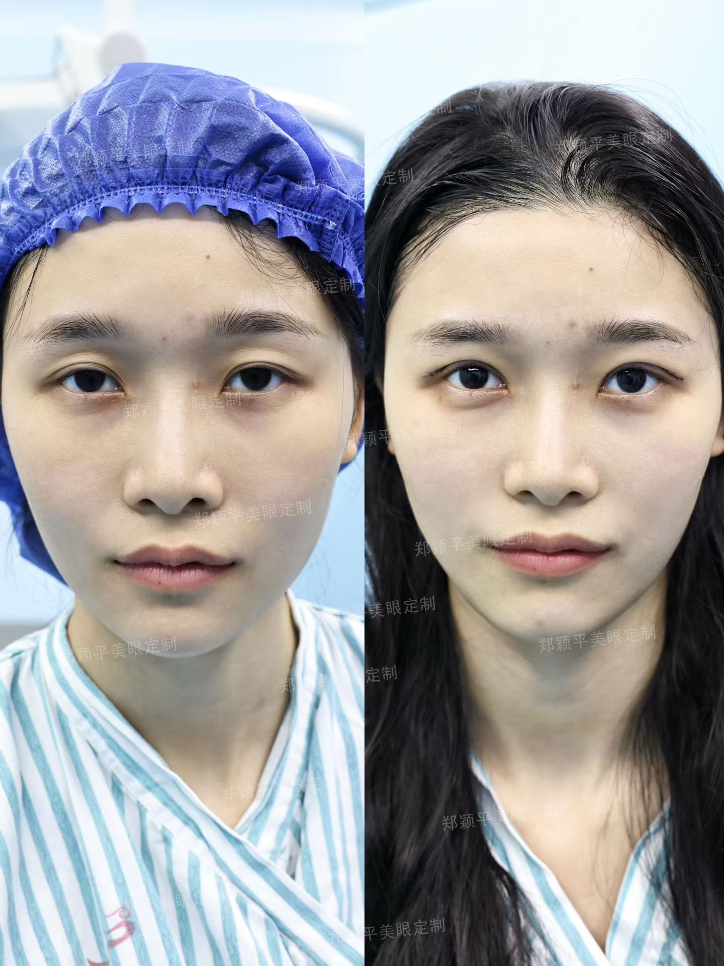 美眼定制✨ 1