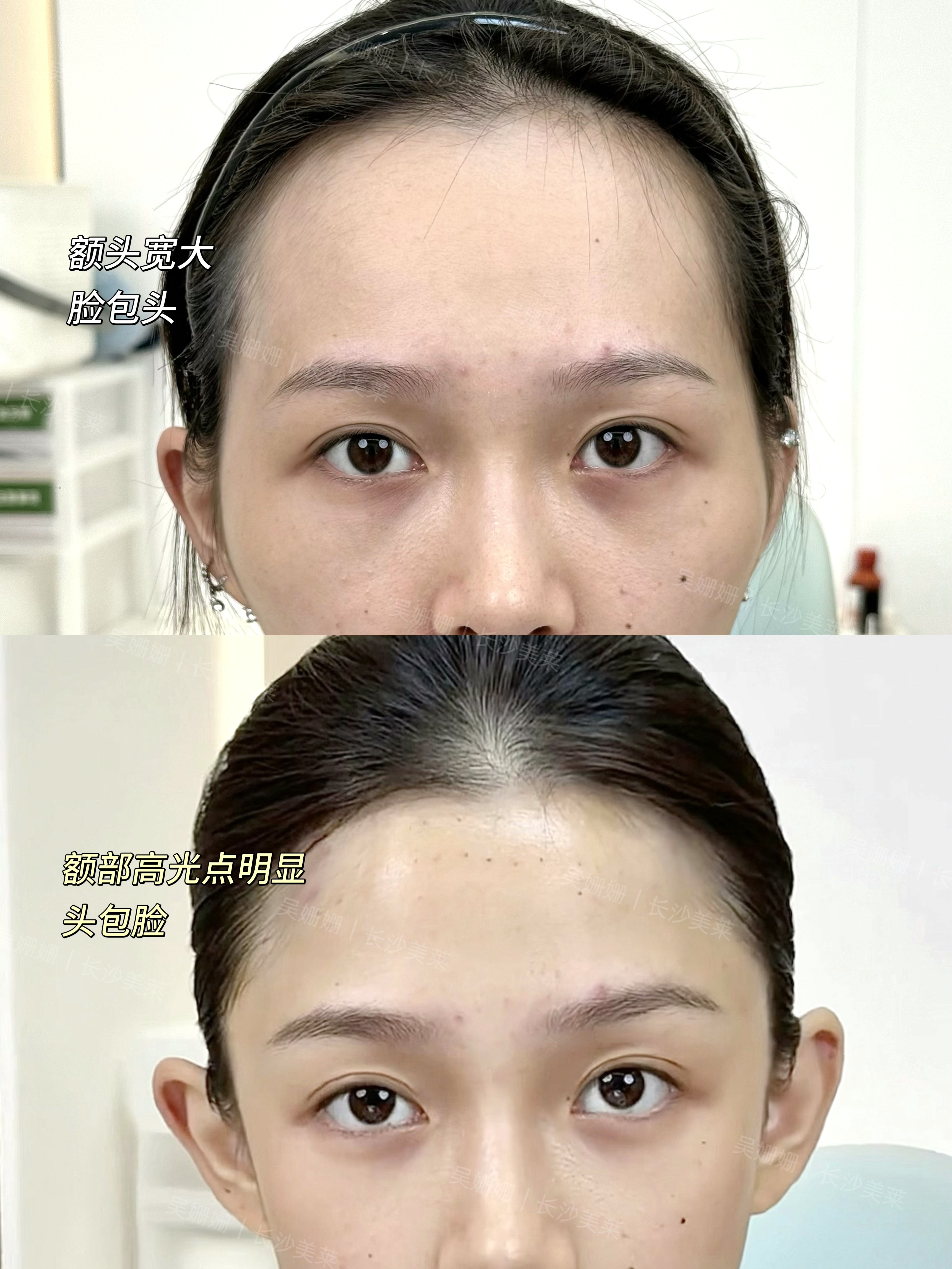 额头才是骨相美女高级感的来源！ 1