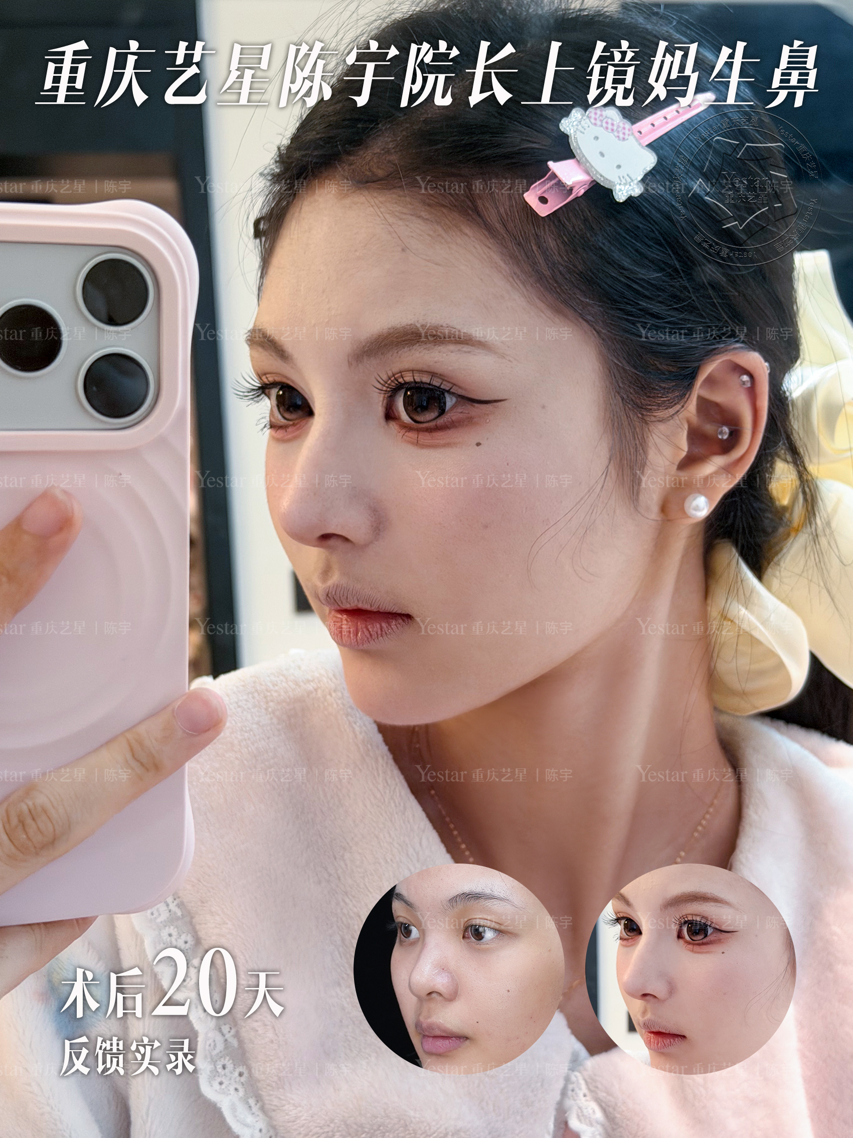 术后20天,越看越耐看💗