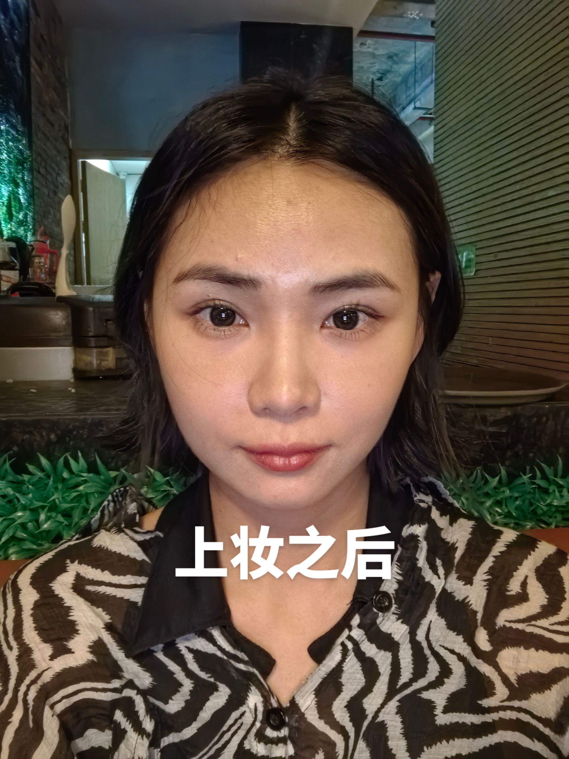 泪沟 11
