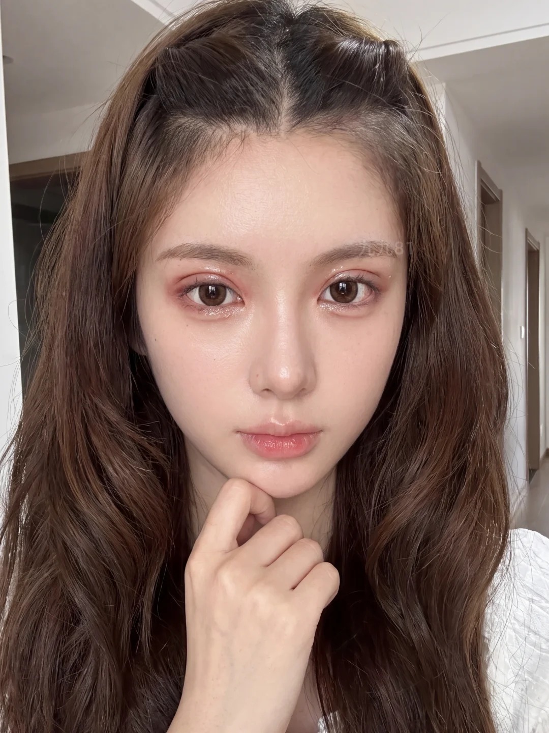 恢复期还有点红肿 1
