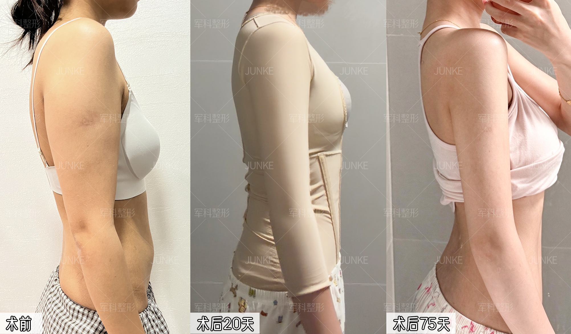 拜拜肉、腰腹小肚子难减❓ 1