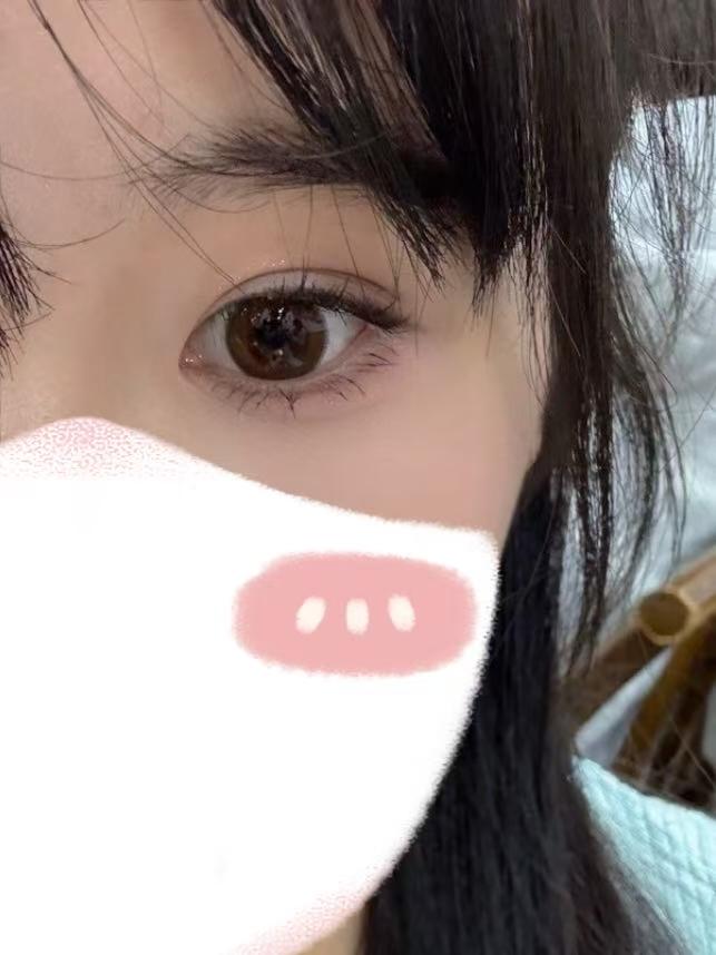 坐标北京，丽合郭锋嘎双眼皮 1
