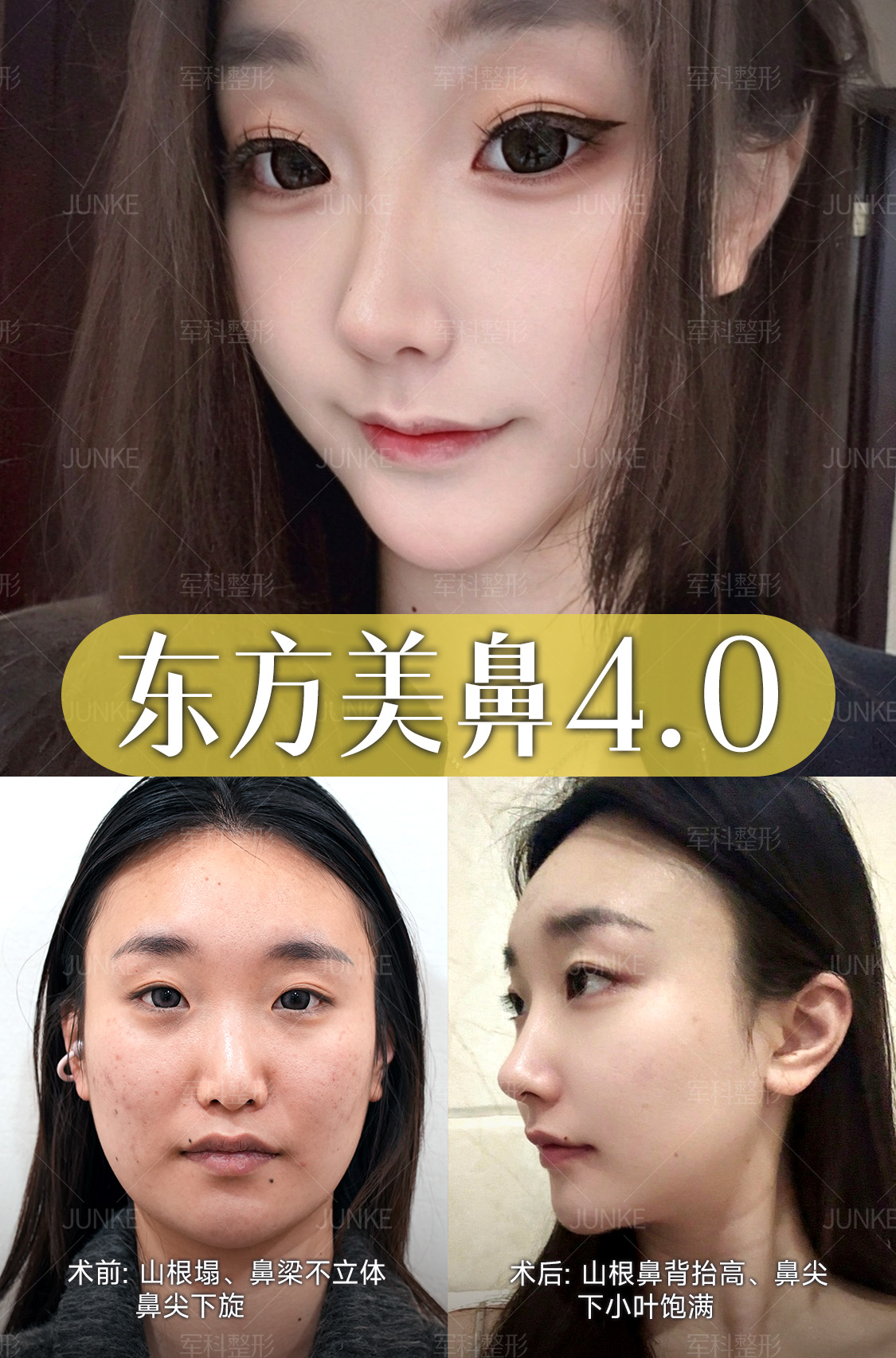 阔面大饼脸秒变骨相女神🌟 1