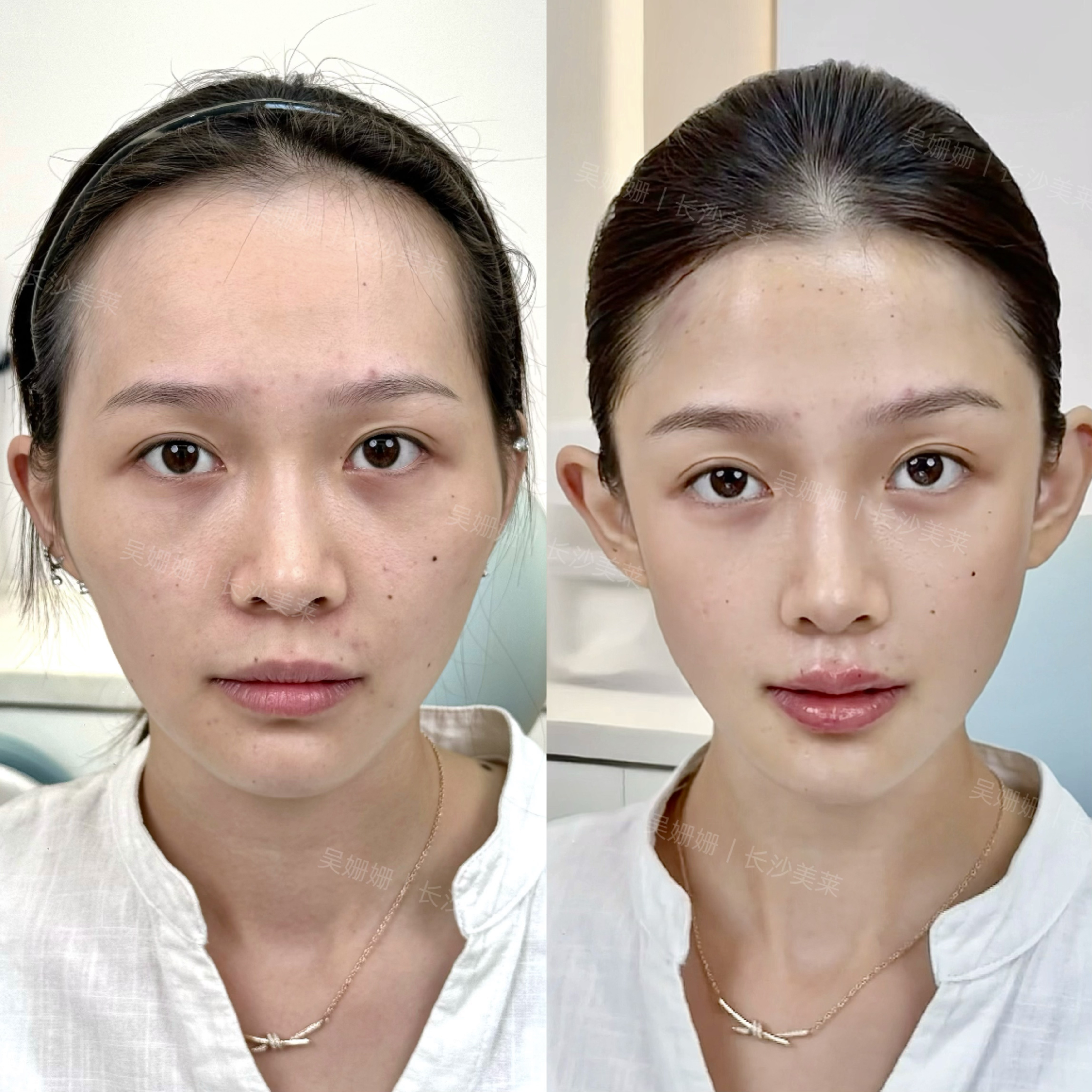 额头才是骨相美女高级感的来源！ 2