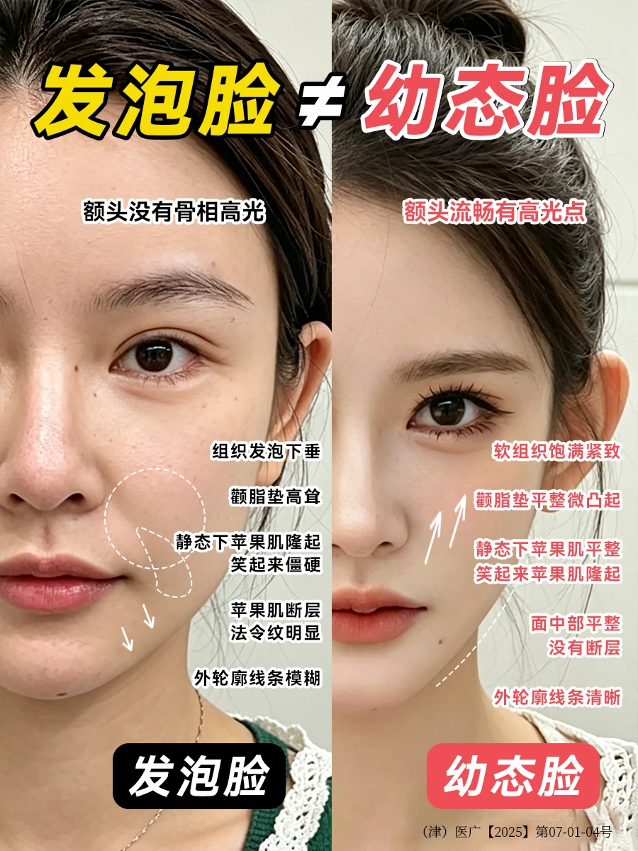 发泡脸≠幼态脸，发泡脸的姐妹看过来！
