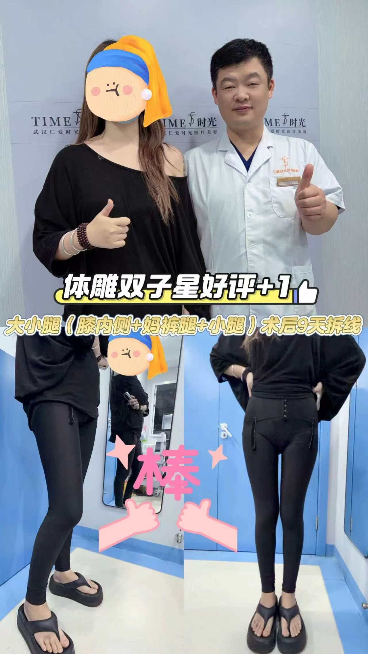 🦵 大小腿吸脂 1