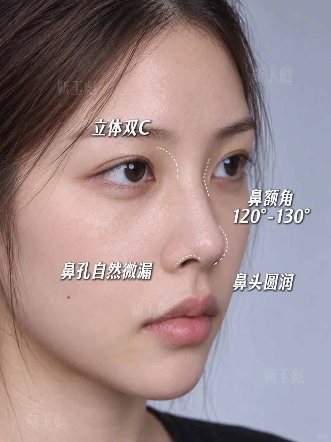 北京鼻子丨直鼻微翘 1